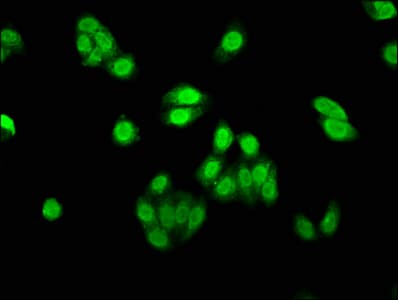 Polyclonal Rabbit anti-Human AEN Antibody (aa117-325)