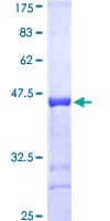 Human LATS1 Protein (Recombinant GST, N-terminus)
