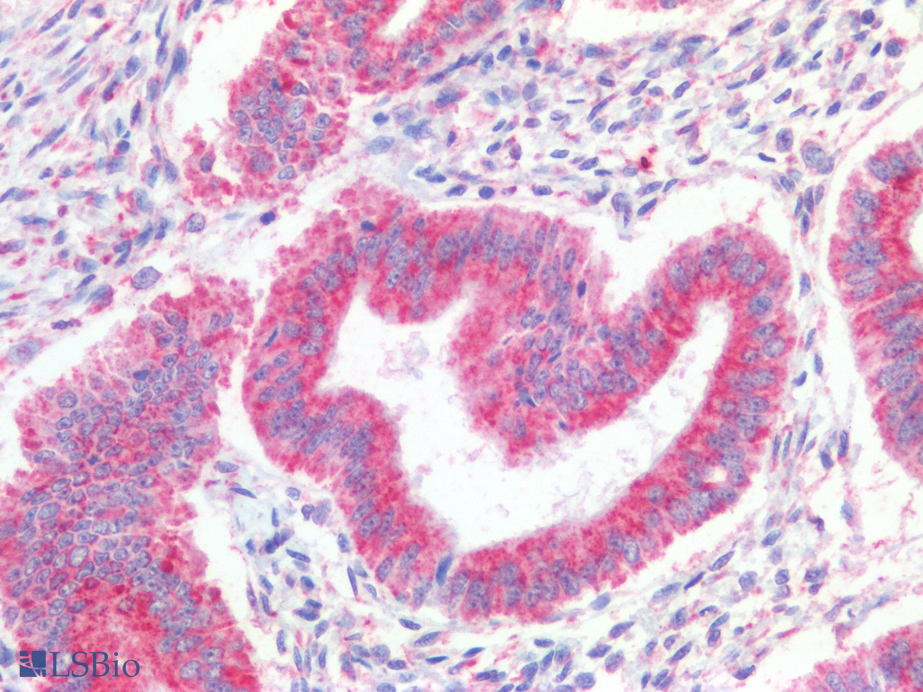 PathPlus™ Polyclonal Rabbit anti-Human c-Kit / CD117 Antibody (Extracellular Domain, IHC)