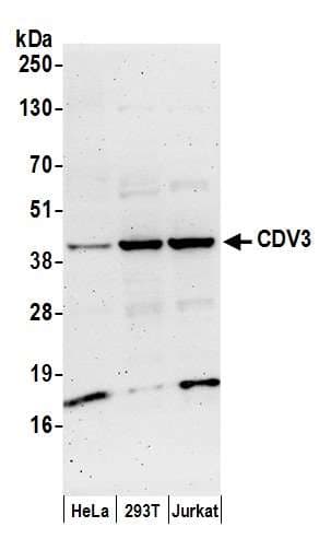 CDV3 Antibody (aa208-258)