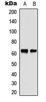 CHEK2 / CHK2 Antibody (Internal)
