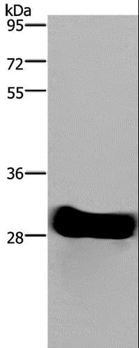Polyclonal Rabbit anti-Human FHL2 Antibody (IHC, WB)