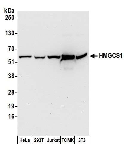 HMGCS1 / HMG-CoA Synthase 1 Antibody (aa470-520)