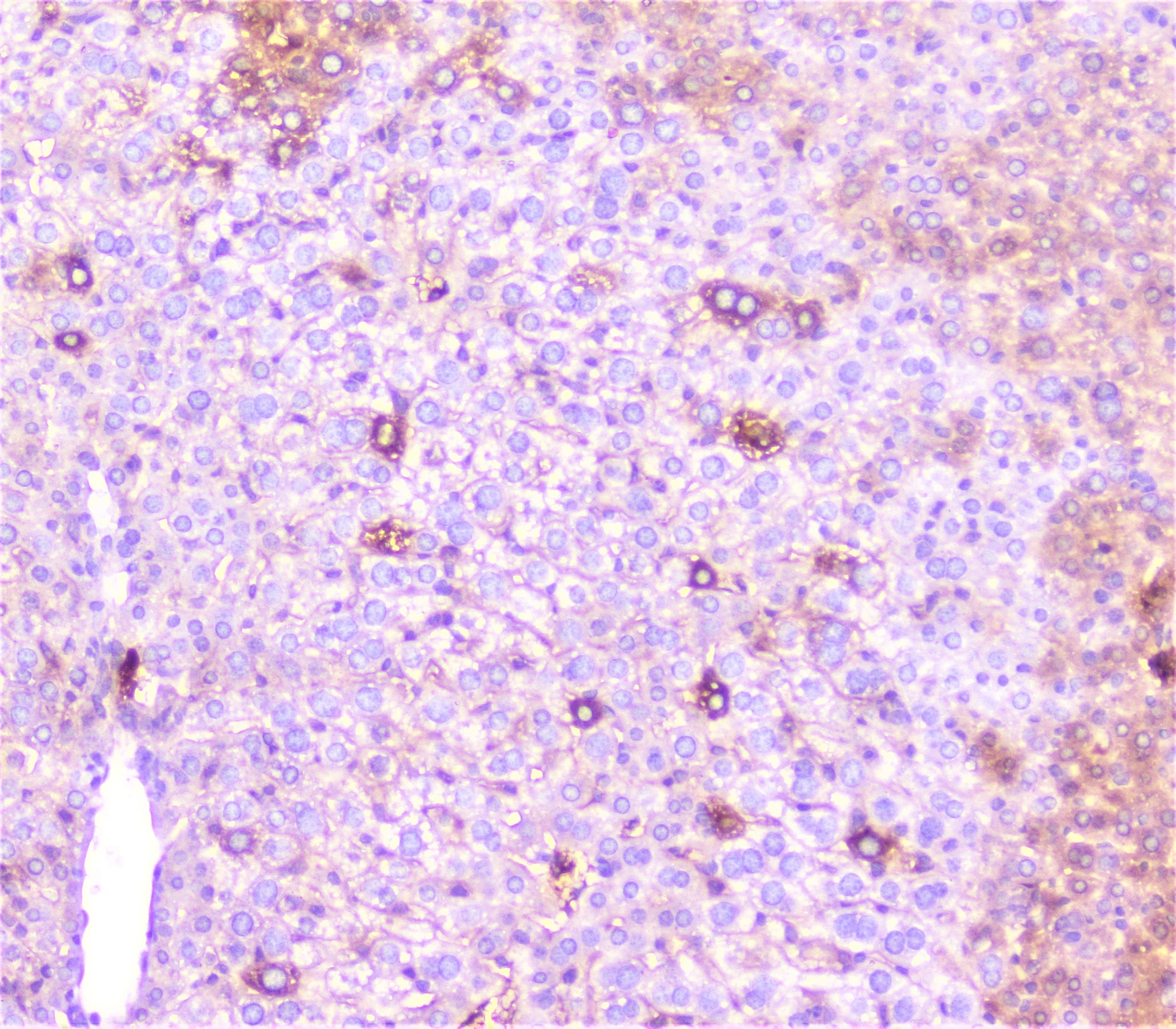 CRP / C-Reactive Protein Antibody