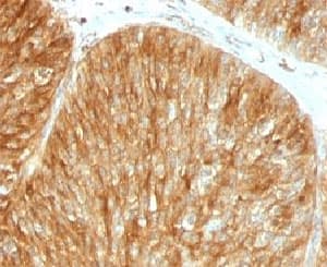 B2M / Beta 2 Microglobulin Antibody (clone B2M/961, Ready-to-Use)