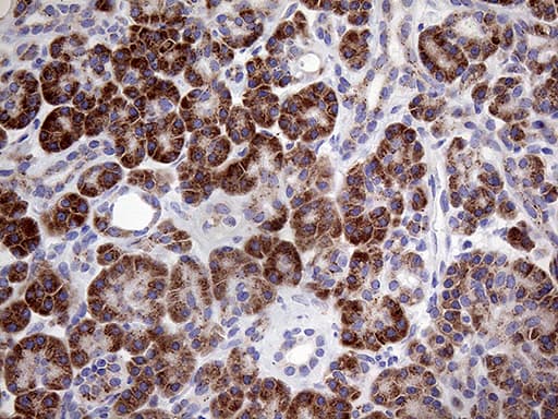 MYOT / Myotilin Antibody (clone OTI5E11, Carrier-free)