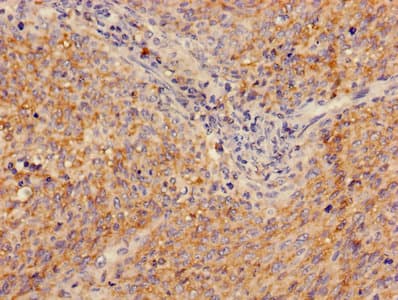 ADA / Adenosine Deaminase Antibody (aa157-343)