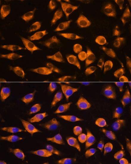 CEP55 Antibody