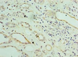 ST8SIA2 / STX Antibody (aa24-160)