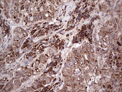 MTDH / Metadherin Antibody (aa70-582, clone OTI1H1)