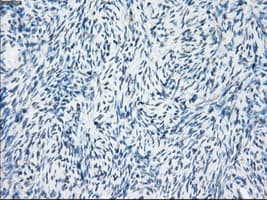 FRA-1 / FOSL1 Antibody (clone OTI12F9)