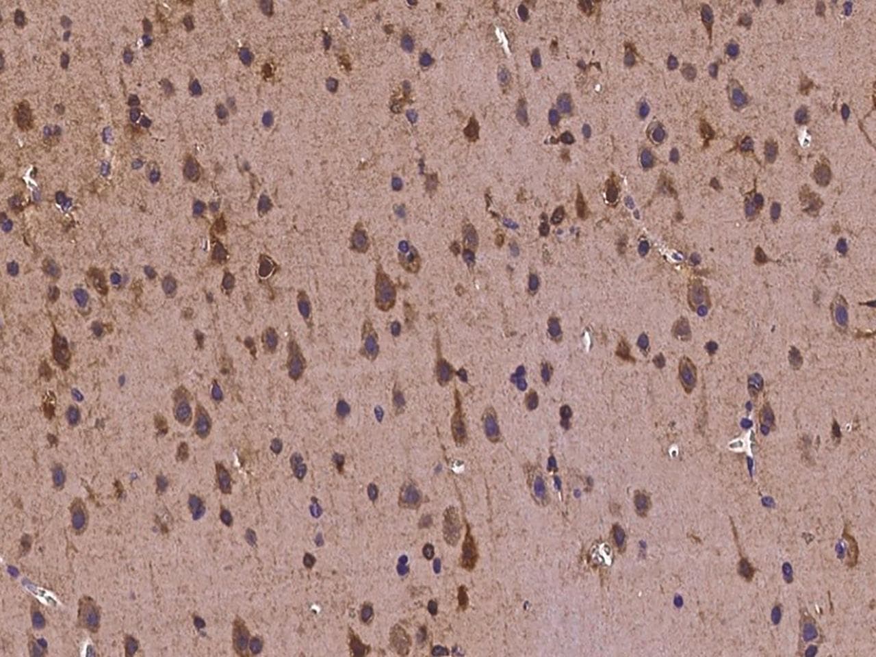 Polyclonal Rabbit anti-Human TUB / Tubby Antibody (IHC)