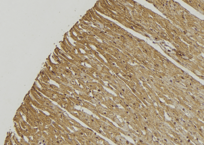 Polyclonal Rabbit anti-Human SCEH / ECHS1 Antibody (IHC, WB)