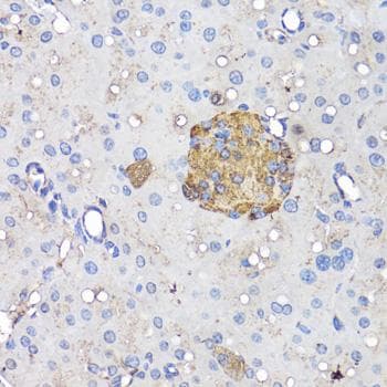 Insulin Antibody