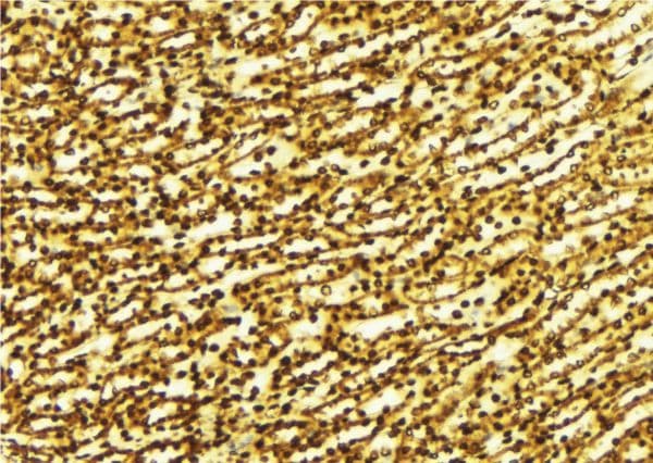 Polyclonal Rabbit anti-Human SIRT1 / Sirtuin 1 Antibody (IHC, WB)