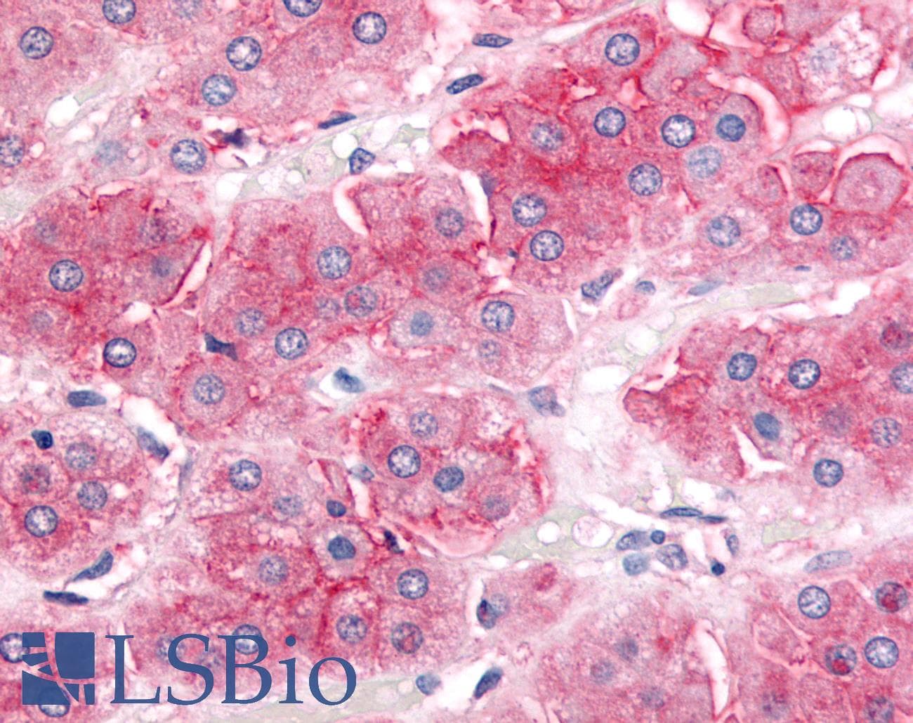 IHC-plus™ ABCB1 / MDR1 / P Glycoprotein Antibody (Cytoplasmic Domain)