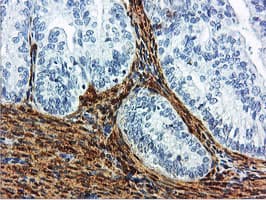 Monoclonal Mouse anti-Human TAGLN / Transgelin / SM22 Antibody (clone 8C8, Carrier-free, IHC, IF, WB)