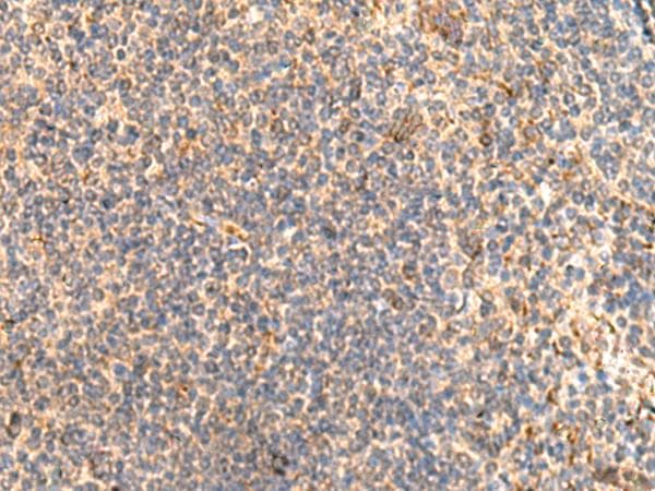 Polyclonal Rabbit anti-Human ABHD2 Antibody (IHC)