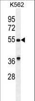 GDF9 / GDF-9 Antibody (aa80-109)