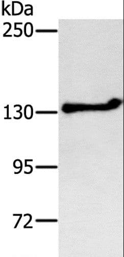 Polyclonal Rabbit anti-Human SDCCAG1 / NEMF Antibody (IHC, WB)