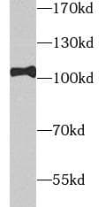 TOP1 / Topoisomerase I Antibody