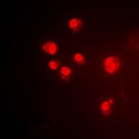 PDCD6 / ALG-2 Antibody