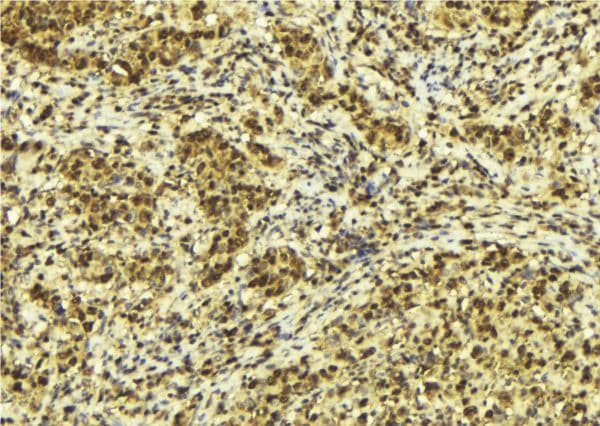 Polyclonal Rabbit anti-Human TRIM68 Antibody (IHC, WB)