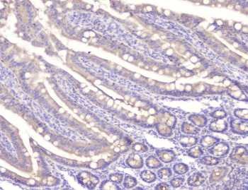 CHM / REP1 Antibody