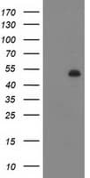 DES / Desmin Antibody (aa104-391, clone 4G1, Carrier-free)