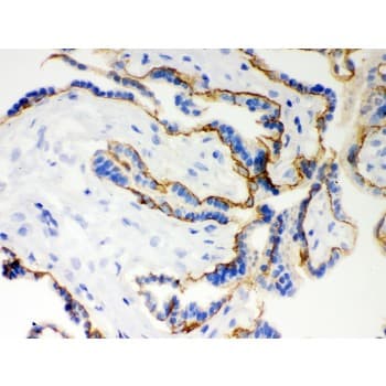 CDH1 / E Cadherin Antibody (aa286-703)