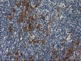 SULT1C2 / Sulfotransferase 1C2 Antibody (clone OTI5A4)