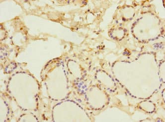 NFKBIE / IKB Epsilon Antibody