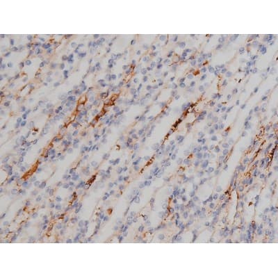 NPM1 / NPM / Nucleophosmin Antibody (phospho-Thr199)