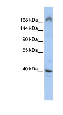 EIF4G1 / EIF4G Antibody (aa539-588)