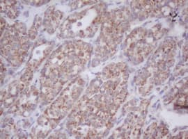 IF3mt / MTIF3 Antibody (aa56-278, clone OTI1E8)