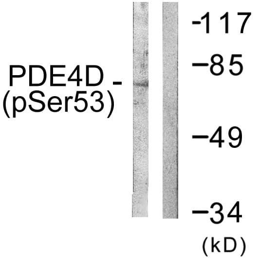 PDE4D Antibody (phospho-Ser190/Ser53)