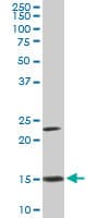IHC-plus™ RPS17 / Ribosomal Protein S17 Antibody (clone 2C7)