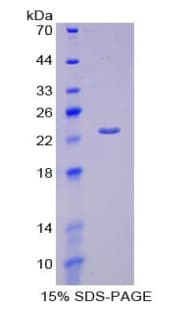 Human HEXB Protein (Recombinant His)