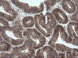 OTUB1 / OTU1 Antibody (clone OTI1E3)
