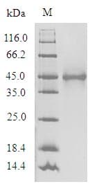 Human OR1A1 Protein (Recombinant 6His-SUMO, N-terminus)