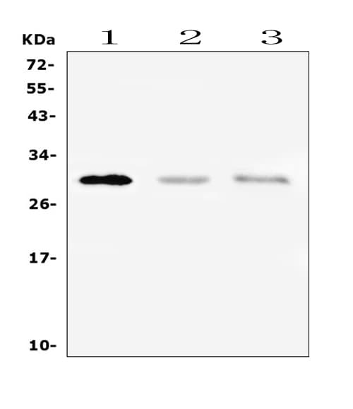 Polyclonal Rabbit anti-Human PTCRA Antibody (WB)