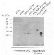IHC-plus™ Polyclonal Sheep anti-Human ACP1 / Acid Phosphatase Antibody (IHC, WB)
