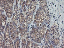 Monoclonal Mouse anti-Human TSC22D1 / TSC22 Antibody (clone OTI4F1, IHC, WB)