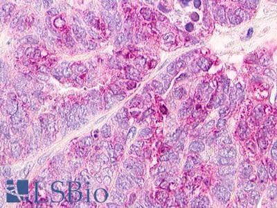 PathPlus™ MLNR/GPR38/Motilin Receptor Antibody (Internal)