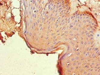 NR2C1 Antibody (aa1-240)