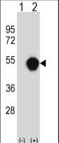 Polyclonal Rabbit anti-Human PXK Antibody (aa221-251, WB)
