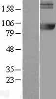 AMPD2 Protein (Over-Expression Lysate Myc-DDK (Flag))