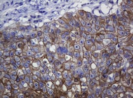 CDH1 / E Cadherin Antibody (clone OTI4F1)