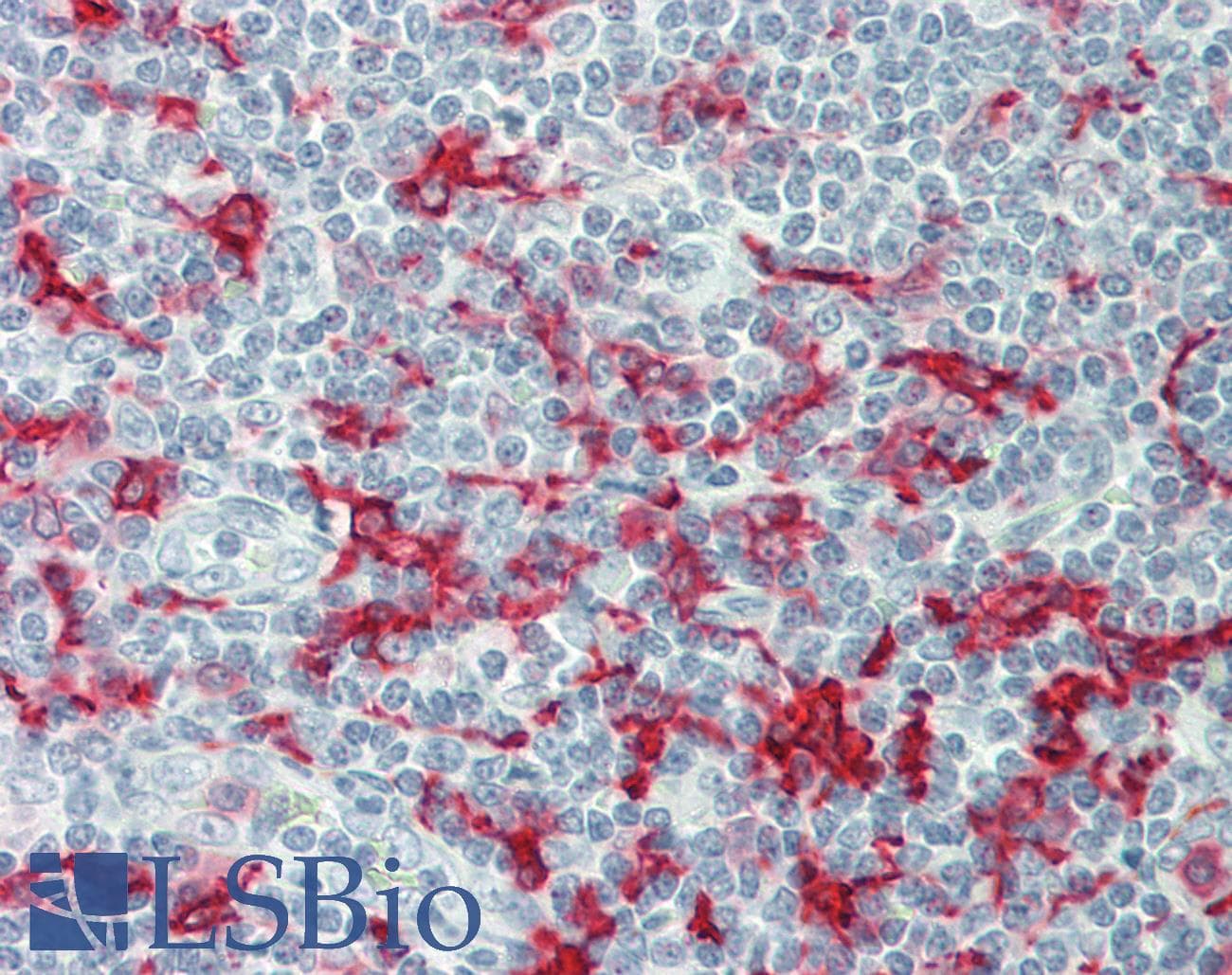 PathPlus™ AIF1 / IBA1 Antibody (aa1-147)