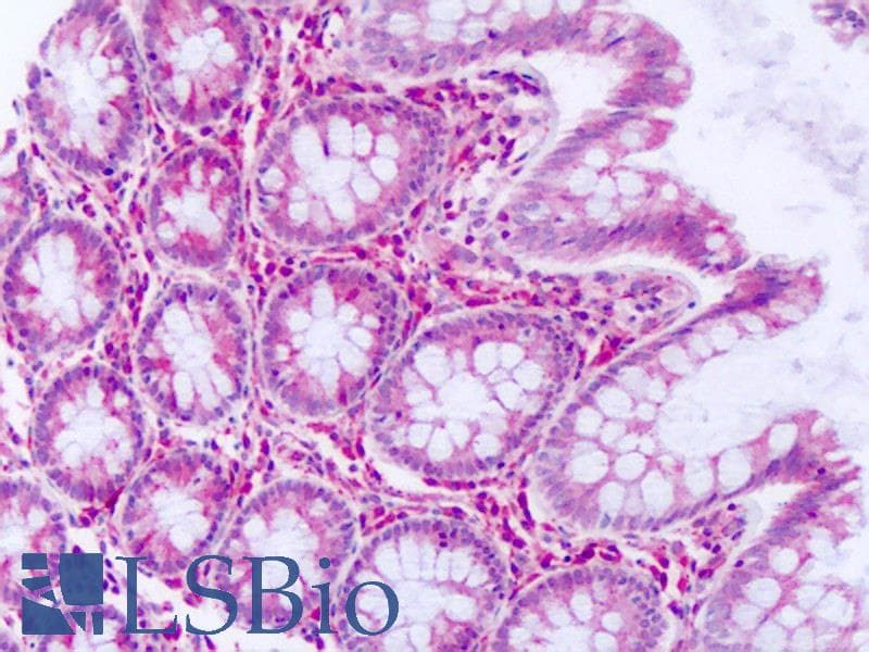 IHC-plus™ DUSP23 Antibody (Internal)